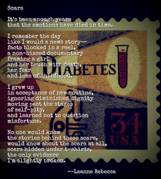 Scars  It’s been enough years that the emotions have died in time.   I remember the day like I would a news story— facts blocked in a reel, a non-biased documentary framing a girl and her brush with death, her fear and loss of childhood.  I grew up in acceptance of new routine, ignoring diminished dignity moving past the stages of self-pity, and learned not to question misfortune.  No one would know the stories behind these scars, would know about the scars at all, scars hidden under t-shirts, the only evidence I’m slightly broken. 